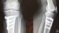 Copie de_IMG_1136